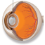 cataract and iol surgery
