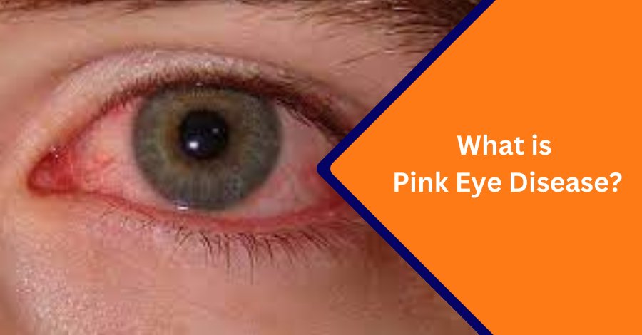 What is Pink eye desease