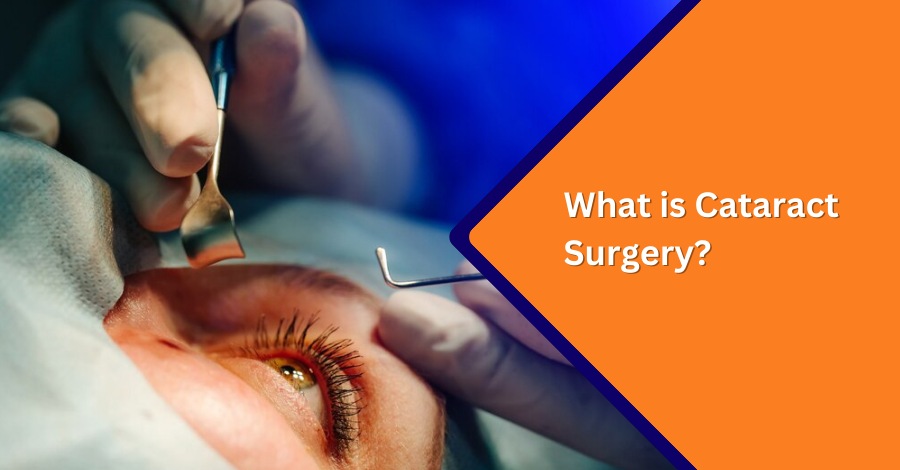 What is Cataract Surgery?