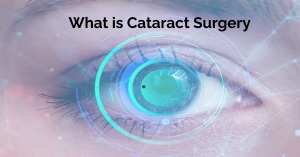 What is Cataract Surgery