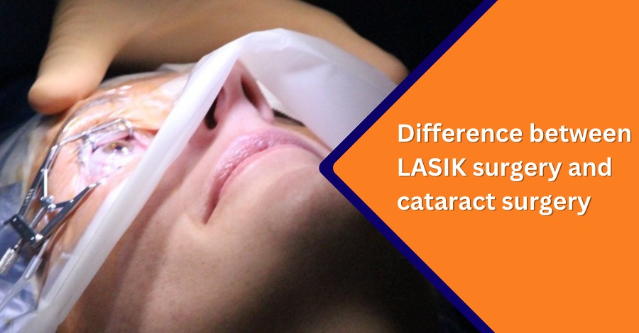 LASIK surgery and cataract surgery