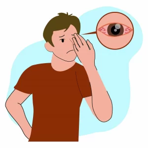 10-most-common-eye-infections